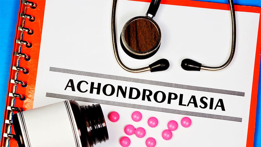 Nuevos hallazgos respaldan la eficacia y seguridad del tratamiento para la acondroplasia
