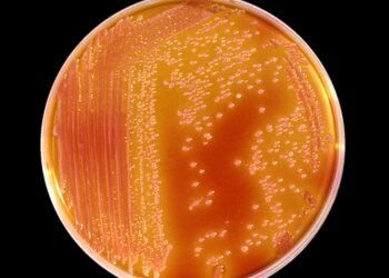 Aumento de casos de meningitis en Mendoza: incertidumbre sobre su origen y nuevos casos en análisis